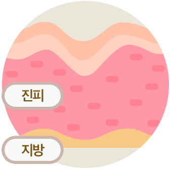 주입
