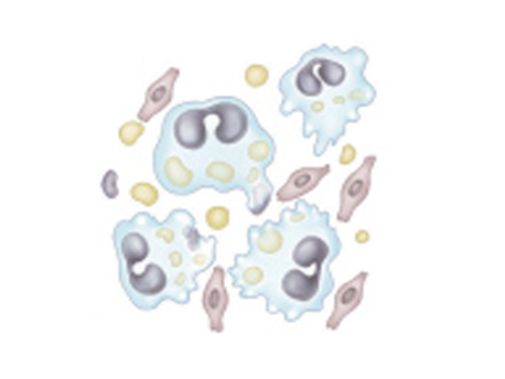 Macrophages move in Fibroblasts multiply
