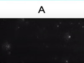 Exosome 3/4