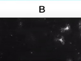 Exosome 4/4