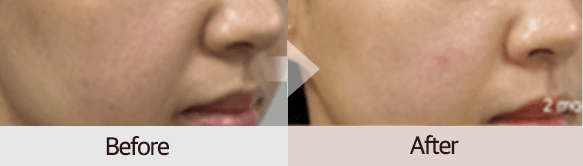 Skin condition