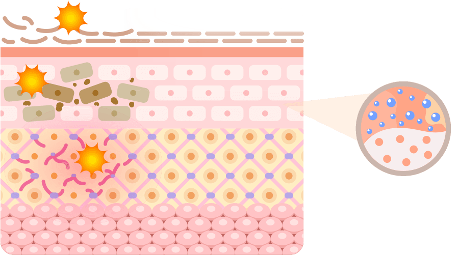 Fill-up Collagen