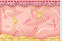 Aged skin structure with thinned collagen fibers