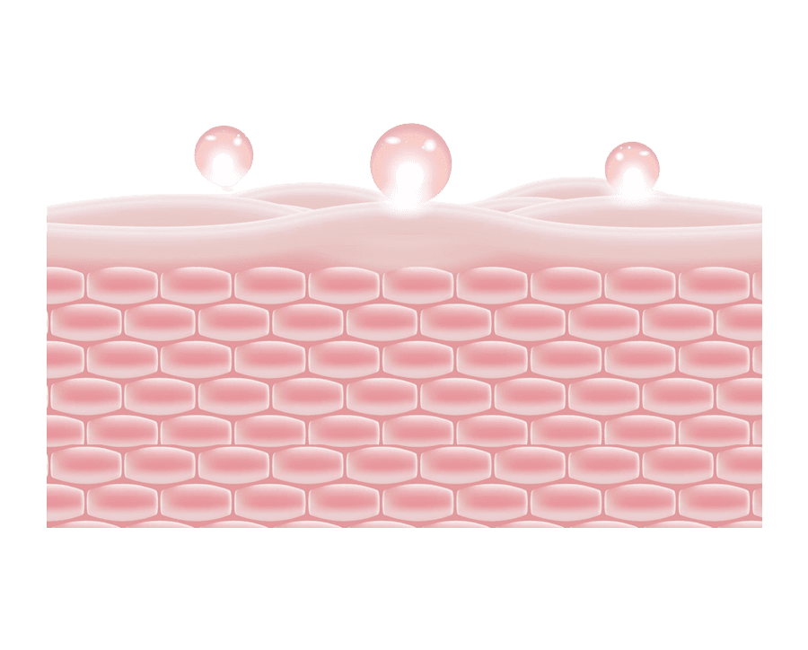 hADM (human Acellular Dermal Matrix)