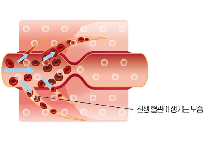 Tissue recovery