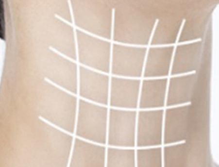 Mixed, across the whole neck