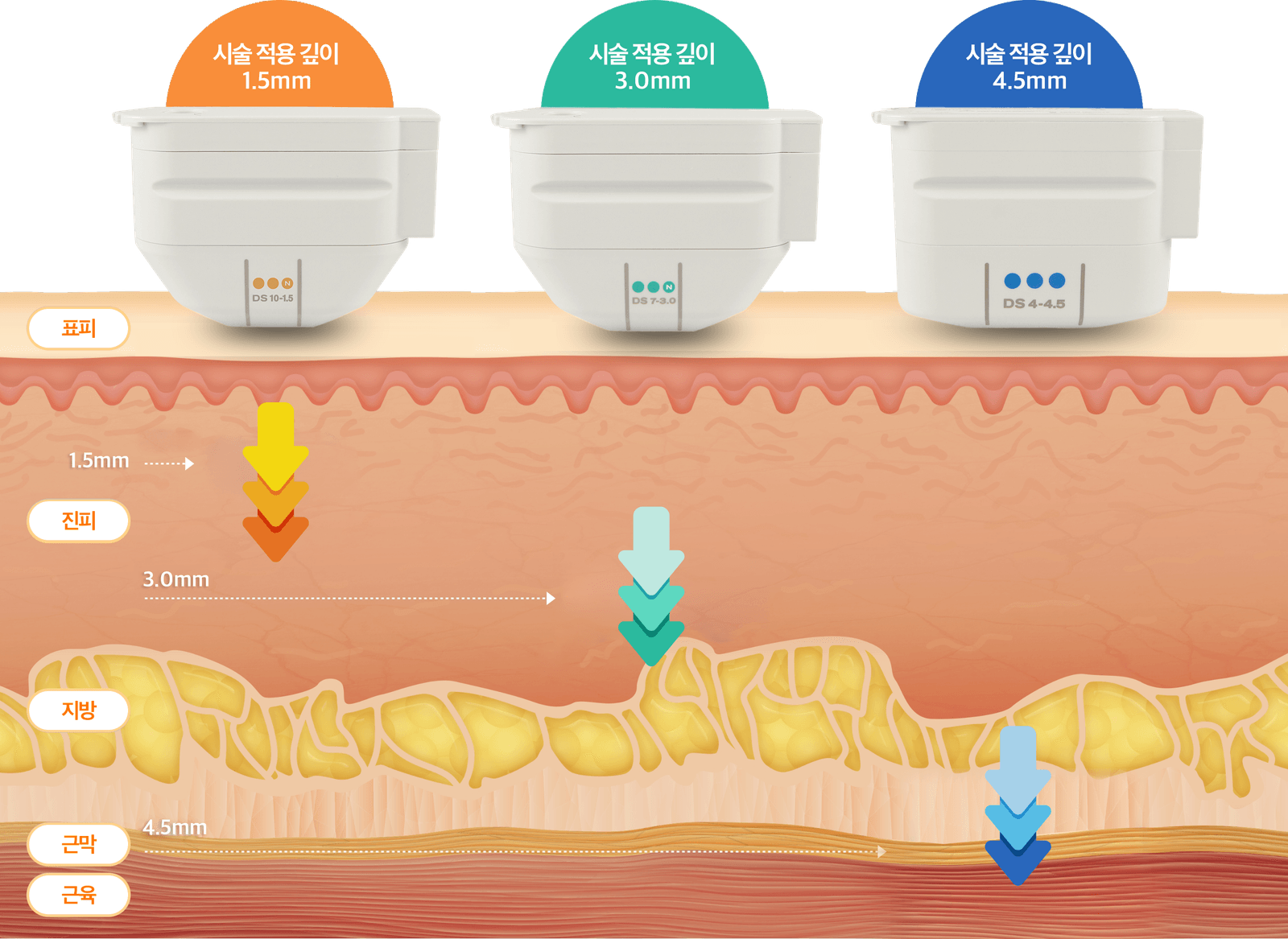 Ultherapy PRIME 不只考量皮膚表面， 連深層皮膚也一併考量進行療程。