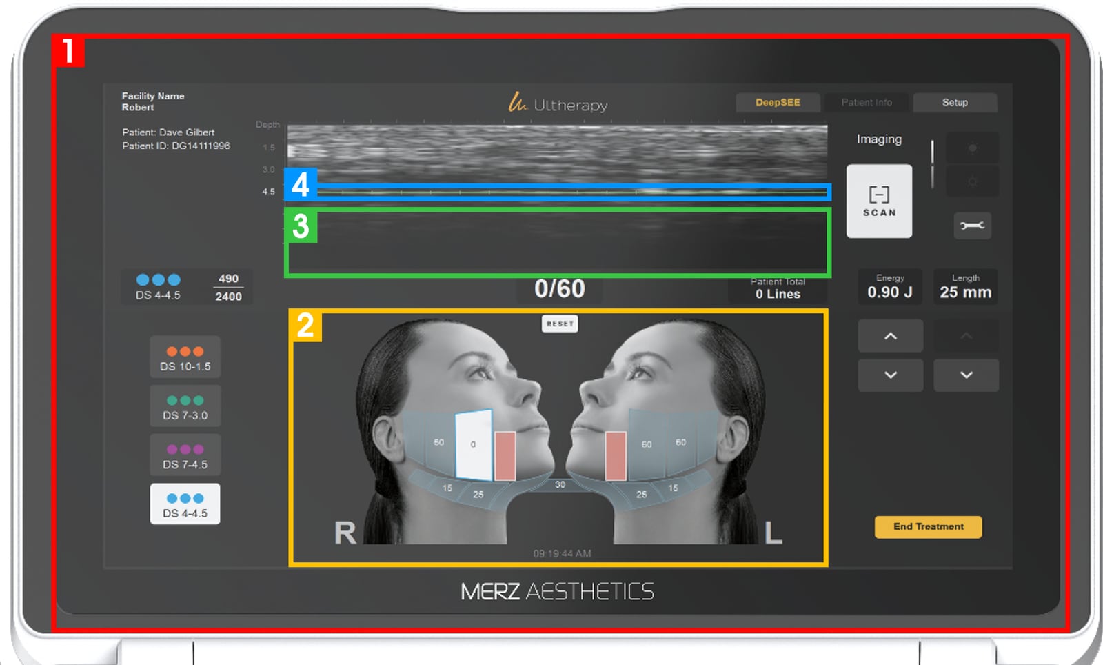 Upgraded technology for a more accurate check of the ‘skin layer’